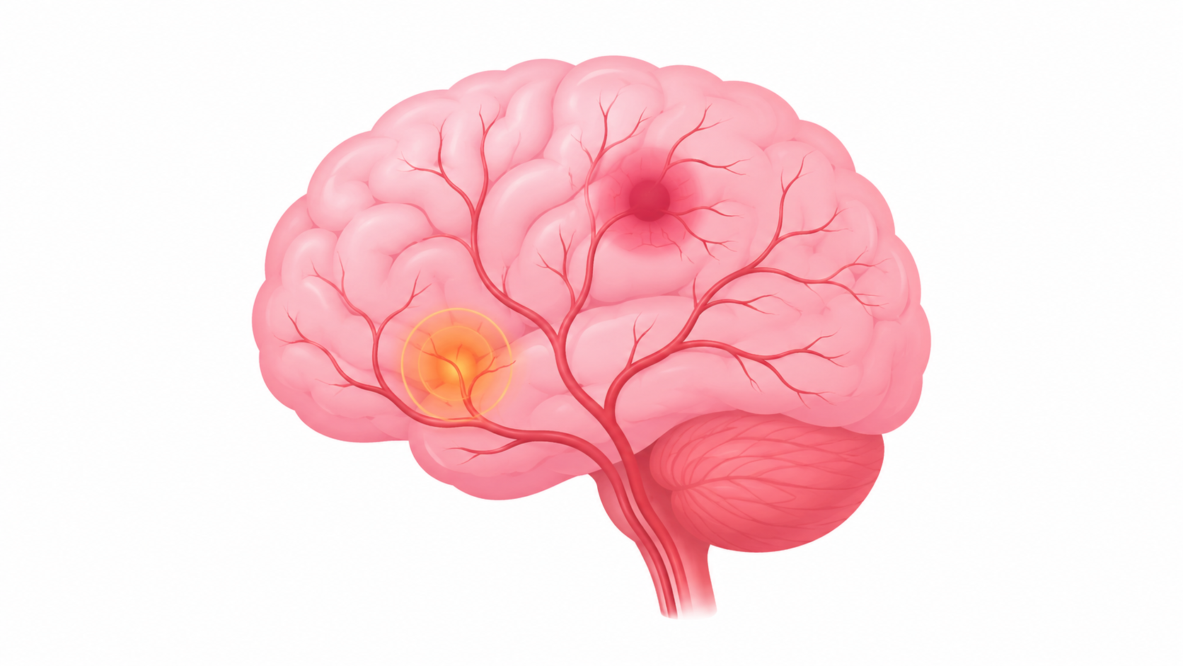 Neurological